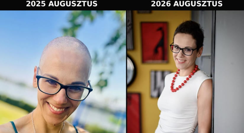 Elég egy meggymag méretű csomó a mellben, hogy baj legyen! – Kata életét az önvizsgálat mentette meg