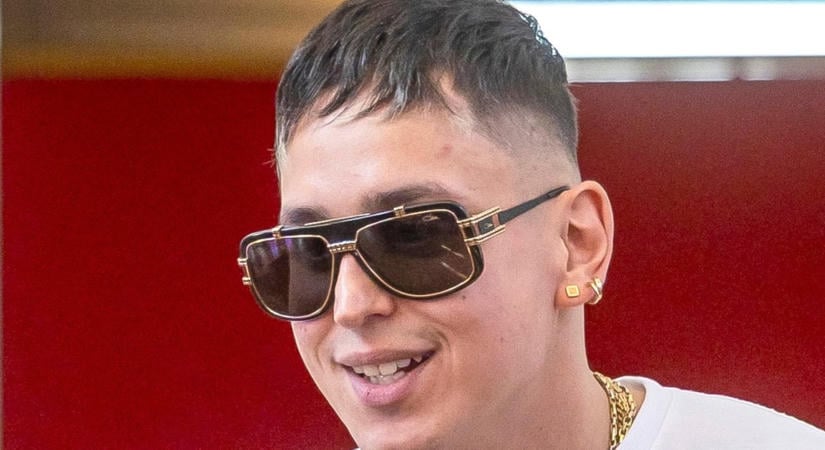 Durván eldeformálódott a kokaintól Aurelio orra: Komoly műtét vár a valóságshow-sztárra