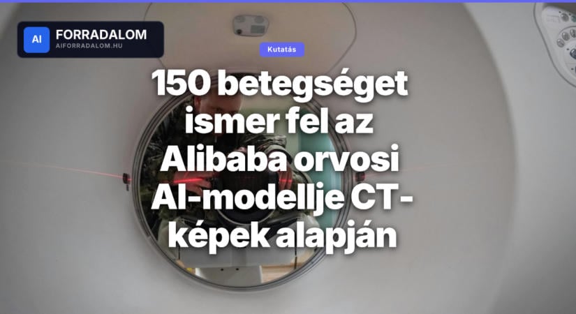 150 betegséget ismer fel az Alibaba orvosi AI-modellje CT-képek alapján