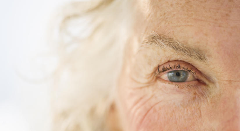 Ez a szemváltozás az Alzheimer-kór kezdetének a korai jele lehet