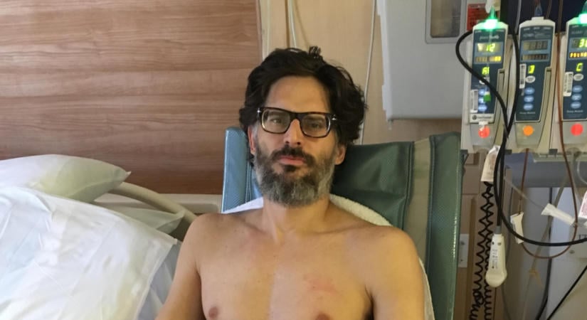 Joe Manganiello sokkoló fotókat posztolt: ilyen volt, amikor a betegségével küzdött