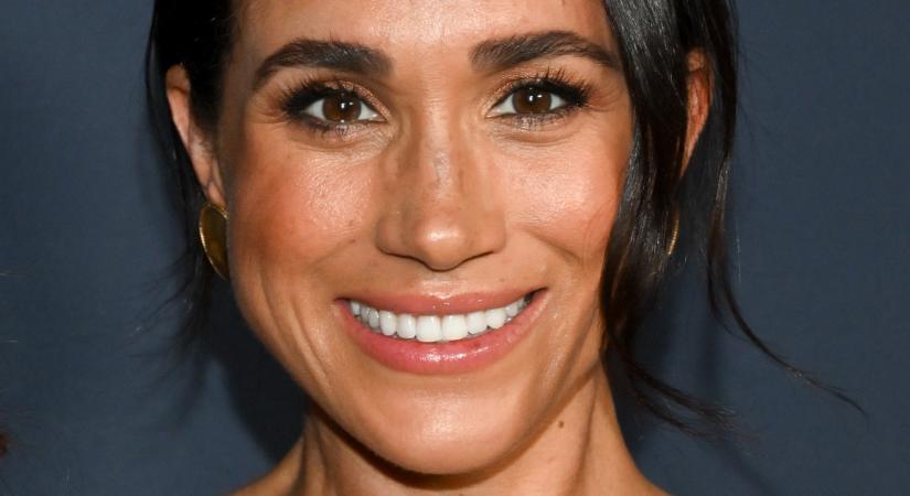Akkor és most fotó: Ezeken a szépészeti beavatkozásokon esett át Meghan Markle a plasztikai sebész szerint
