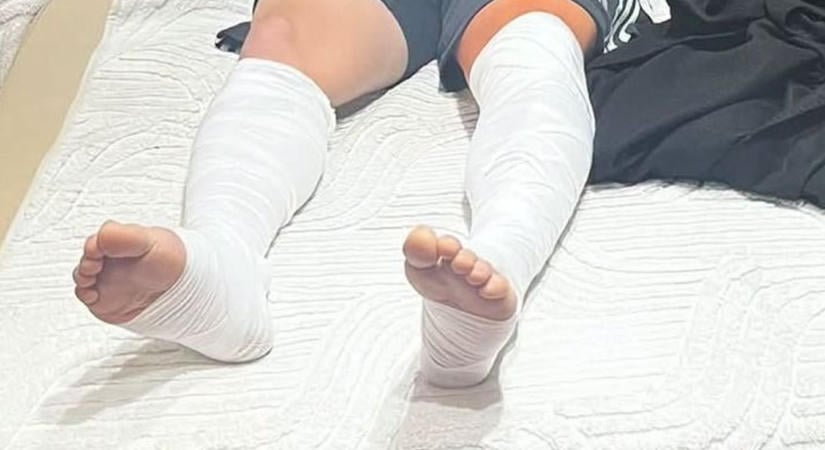 Megműtötték Sándor Tamást - ezért kellett kés alá feküdnie