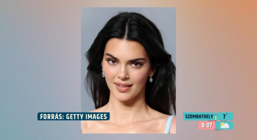 Tagadja az orrplasztikát Kendall Jenner: elárulta, mi áll a megváltozott arcformája mögött