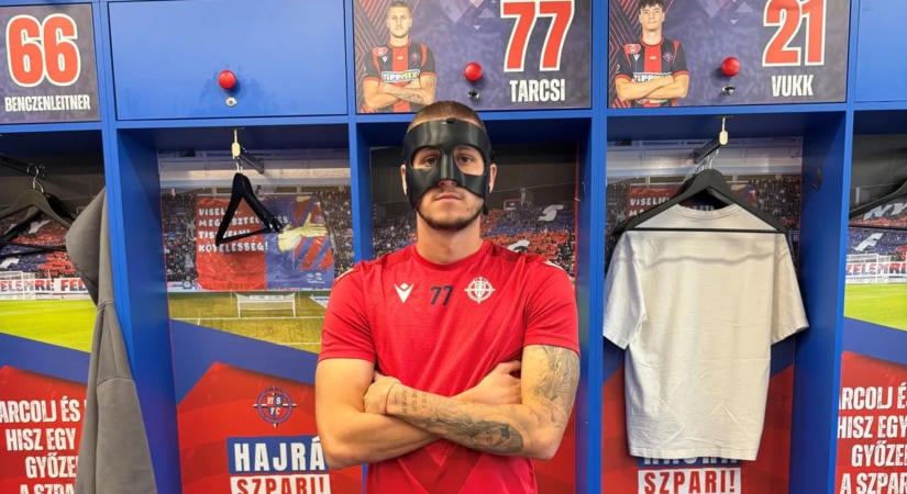 Tarcsi Róbert: Mintha a fél arcom nem is az enyém lenne