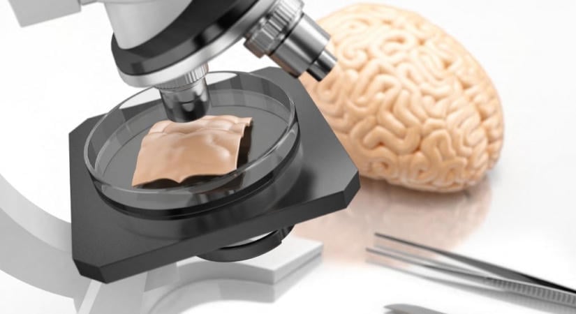 Felfedezhették az Alzheimer-kór kiváltó okát?