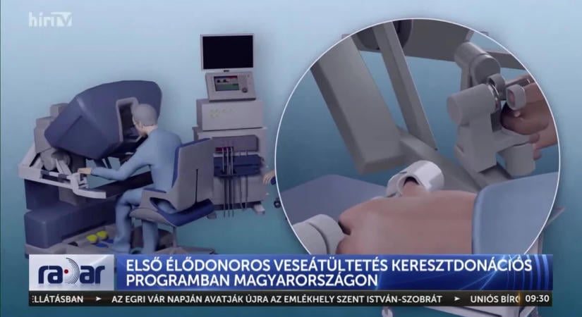 Vesetranszplantáció: Nagy mértékben lerövidülhet a várakozási idő