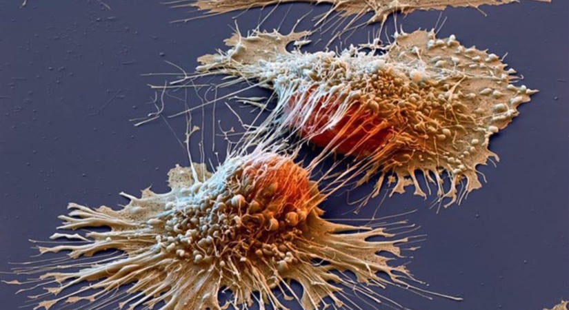 Eltűnt a hasnyálmirigyrák az mRNS immunterápia után az egerekben