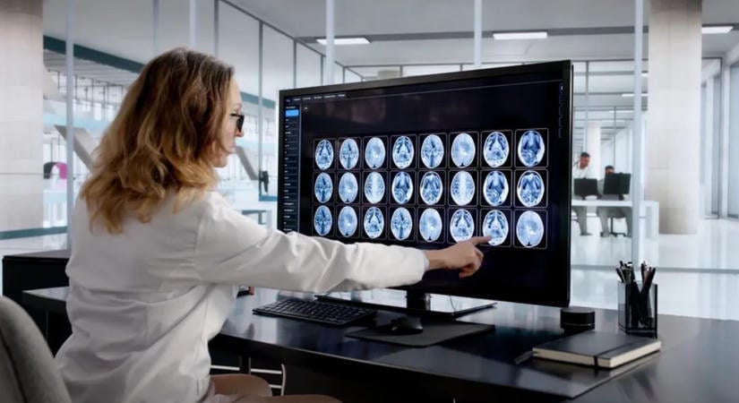 MRI-vizsgálat mutatta meg, mi történik a női aggyal a menopauza idején