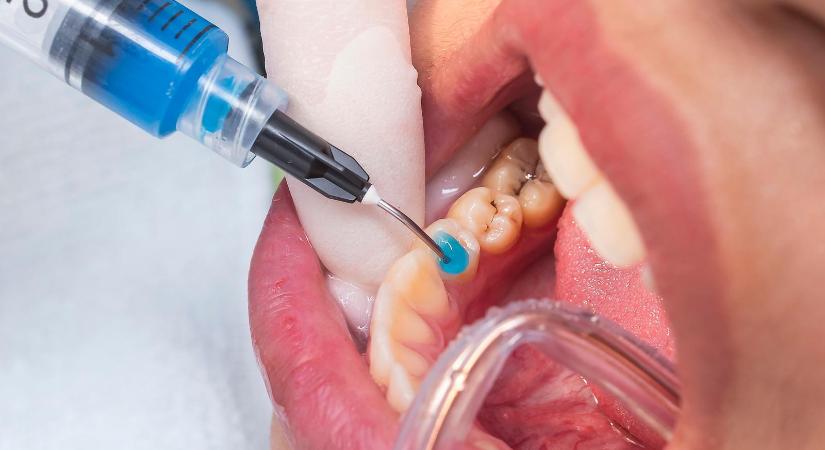 Tömés, implantátum, korona helyett jobb lenne a fognövesztés, de még messze van a megoldás