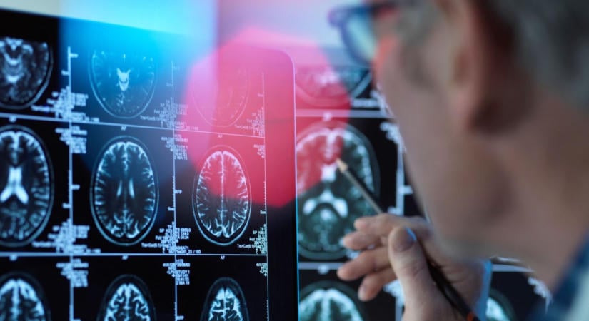 Így előzhető meg a retteget kór: titkok a kaposvári Alzheimer Café alapítóitól