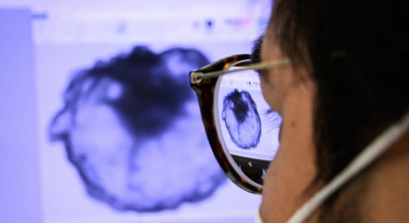 Megtalálták a daganatok gyenge pontját, hatásosabb lehet az immunterápia