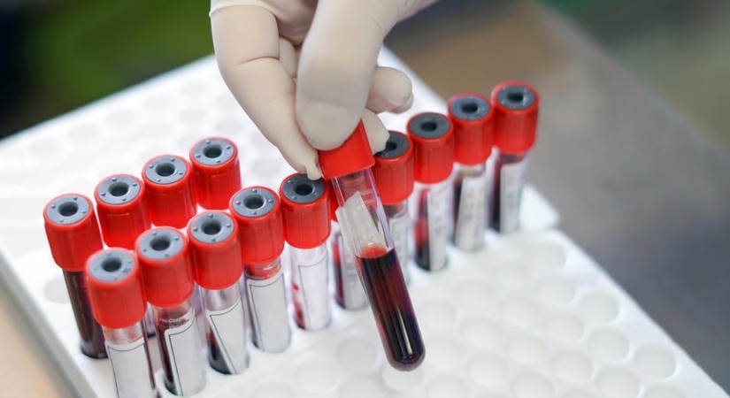 Titokzatos pestisjárvány tartja rettegésben a világot, már a WHO is megszólalt