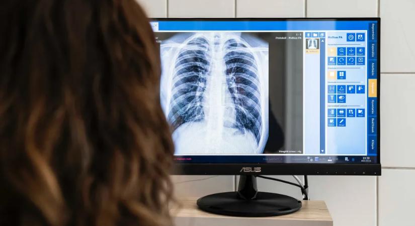 Ígéretes rák elleni injekció van a piacon, de a magyar betegek egyelőre nagyon nehezen férhetnek hozzá
