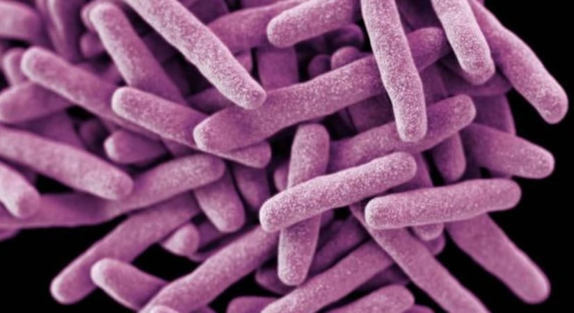 49 millió ember vizsgálatából kiderült valami aggasztó a rák és egy baktérium kapcsolatáról