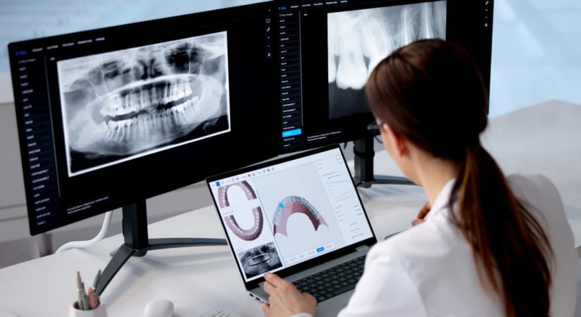 Tényleg működik a villámgyors implantáció? A szakértő elárulja az igazságot