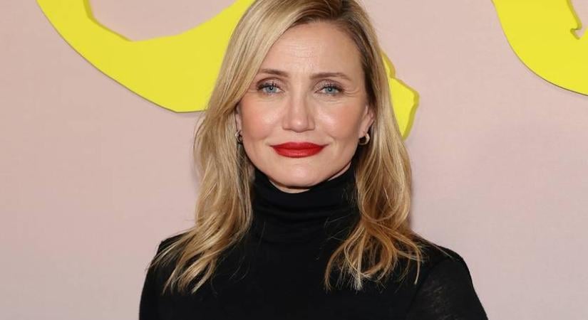 Cameron Diaz inspiráló vallomása a botoxról: „Inkább nézem az öregedő arcomat”