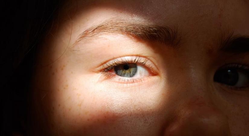 Lézeres szemműtét típusok összehasonlítása – PRK, LASIK vagy SMILE kezelés?