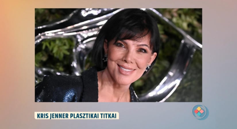 69 évesen feküdt újra kés alá Kris Jenner – de vajon megereszkedett a legutóbbi faceliftje?