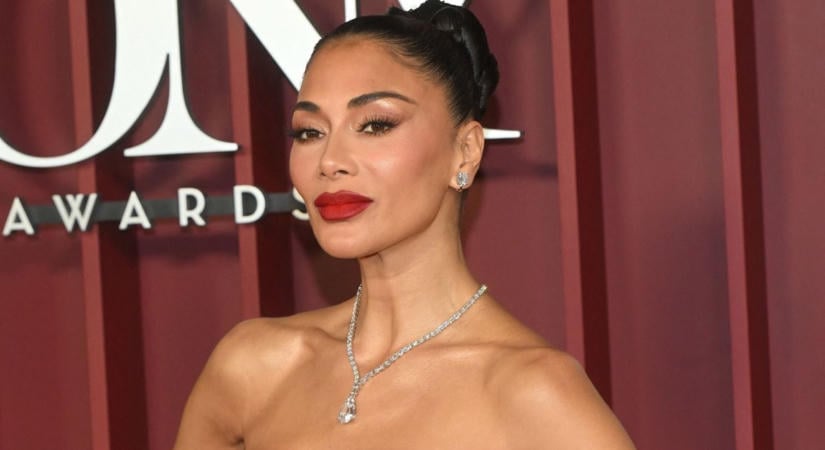 Felhólyagosodott sebek borítják Nicole Scherzinger lábát: ez történt az énekesnővel – Fotó