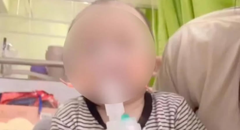 Felfoghatatlan kórházi horror: az ápoló ollóval levágta az egyéves kisfiú ujját