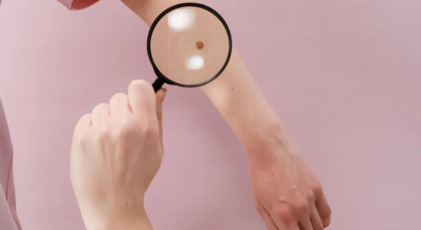 Rákkal diagnosztizálták a fiatal nőt, most így védené meg gyermekét