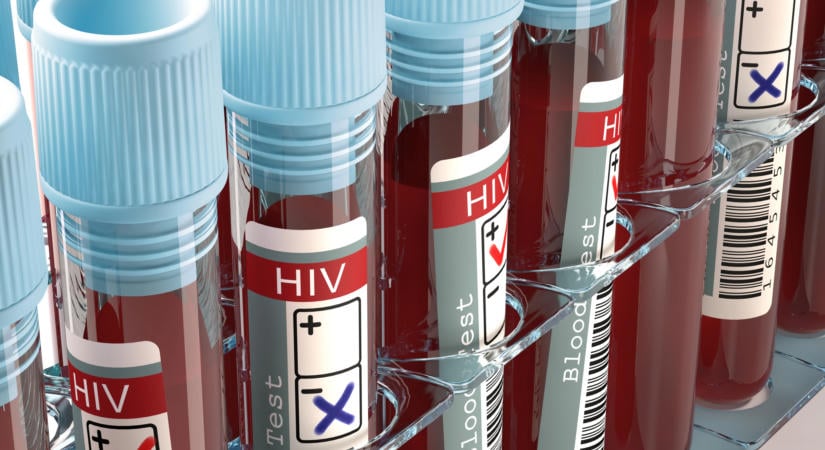 Riasztó méreteket ölt a HIV-járvány Oroszországban