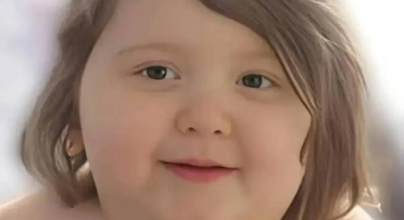 115 kilósan került kórházba a hétéves kisfiú: nem sokkal később belehalt a túlsúlyba