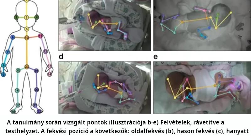 Hazai fejlesztésű AI-kamera védheti a koraszülötteket