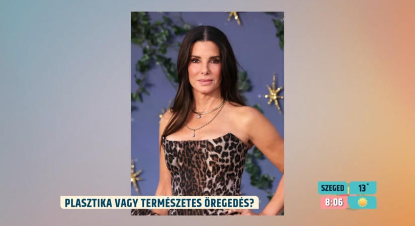 Arcimplantátum vagy csak allergia? Újra fellángoltak a találgatások Sandra Bullock körül