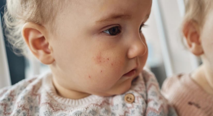 Dr. Novák Hunor: „Sok szülő költ százezreket felesleges vizsgálatokra”