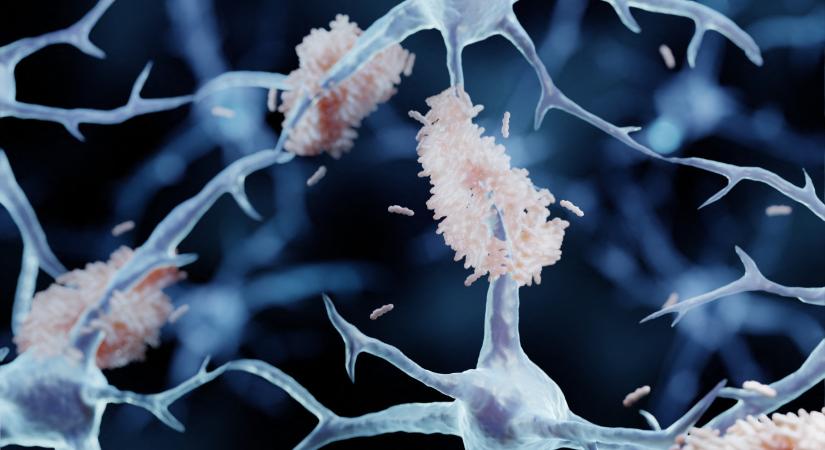 A magas dózisú szén-dioxid belélegzése kimoshatja az agyból az Alzheimer-kórt okozó fehérjéket